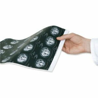 DICOM Print Server